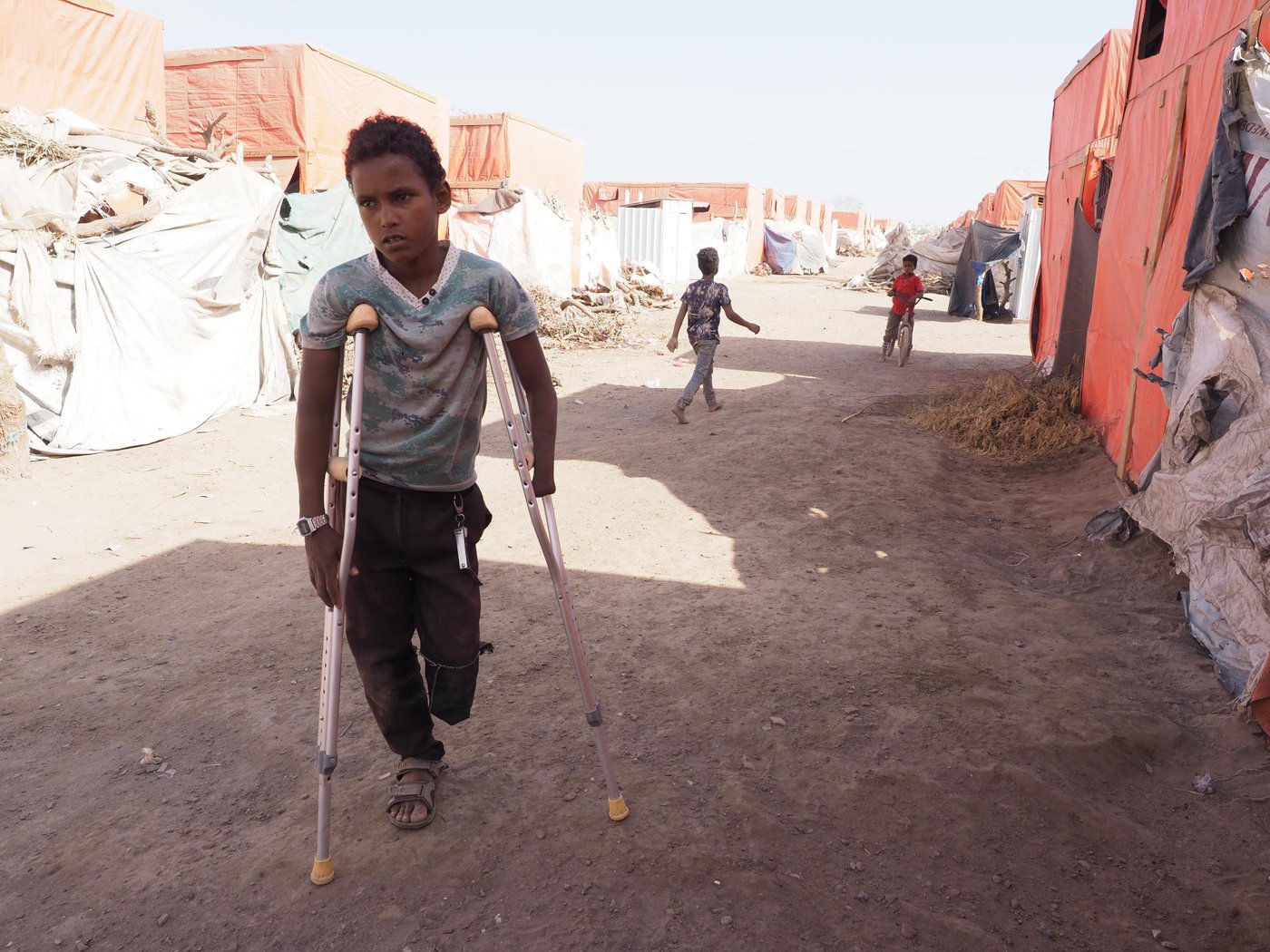 Salah is a young internally displaced boy (13 years old). He fled from Taiz city because of the war, and he now lives in Al-Mishqafa IDP camp in Lahj. One day while he was out grazing his sheep along with two female relatives, one of the girls found a shell and brought it back with her. While they were playing Salah knocked on the shell. He didn`t know that it would explode. It exploded on him and the two girls. He suffered injuries to his stomach, and one of his hands and one of his foot had to be amputated.
Salah misses his home, playing with his old friends, playing football and riding his bicycle.
Photo: Ingrid Prestetun/NRC
